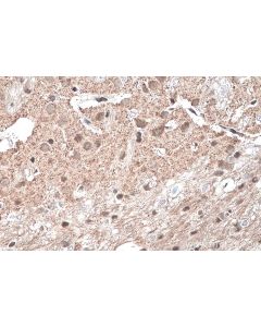 IHC easy ® YY1 Ready-To-Use IHC Kit KHC0132 proteintech