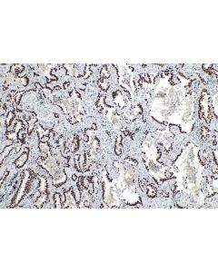 IHC easy ® FOXA2 Ready-To-Use IHC Kit KHC0140 proteintech