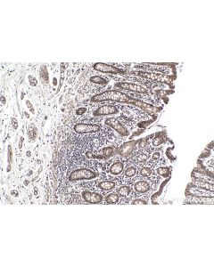IHC easy ® VIRMA/KIAA1429 Ready-To-Use IHC Kit KHC0149 proteintech