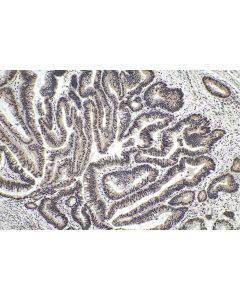 IHC easy ® YTHDC1 Ready-To-Use IHC Kit KHC0155 proteintech