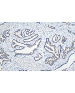IHC easy ® UCP2 Ready-To-Use IHC Kit KHC0247 proteintech