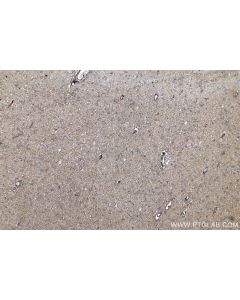 IHC easy ® VAT1 Ready-To-Use IHC Kit KHC0270 proteintech