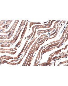 IHC easy ® Utrophin Ready-To-Use IHC Kit KHC0289 proteintech