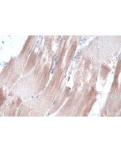 IHC easy ® Telethonin Ready-To-Use IHC Kit KHC0312 proteintech