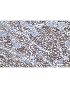 IHC easy ® UGT2B4 Ready-To-Use IHC Kit KHC0470 proteintech