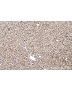 IHC easy ® UGT2B7 Ready-To-Use IHC Kit KHC0471 proteintech