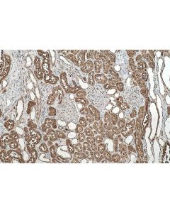 IHC easy ® TXN Ready-To-Use IHC Kit KHC0529 proteintech