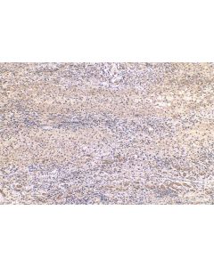 IHC easy ® YWHAZ Ready-To-Use IHC Kit KHC0559 proteintech