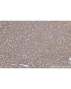 IHC easy ® VDAC1 Ready-To-Use IHC Kit KHC0588 proteintech
