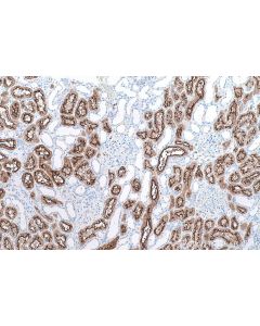 IHC easy ® VIL1 Ready-To-Use IHC Kit KHC0601 proteintech