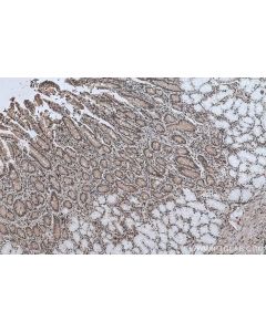 IHC easy ® NFKB1 p50 Ready-To-Use IHC Kit KHC0635 proteintech
