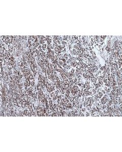 IHC easy ® TYMS Ready-To-Use IHC Kit KHC0649 proteintech