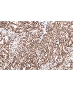 IHC easy ® UBA1 Ready-To-Use IHC Kit KHC0679 proteintech