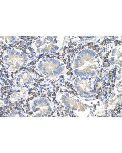 IHC easy ® TXNDC5 Ready-To-Use IHC Kit KHC0685 proteintech