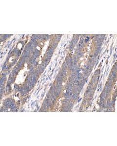 IHC easy ® YWHAB Ready-To-Use IHC Kit KHC0701 proteintech