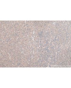 IHC easy ® VEGFA/VEGF Ready-To-Use IHC Kit KHC0735 proteintech