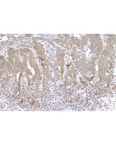 IHC easy ® UBD Ready-To-Use IHC Kit KHC0783 proteintech