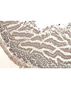 IHC easy ® VCP Ready-To-Use IHC Kit KHC0830 proteintech
