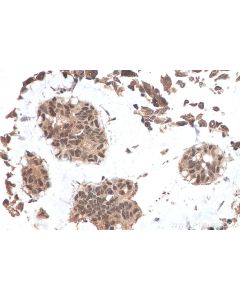IHC easy ® UBE2N Ready-To-Use IHC Kit KHC0872 proteintech
