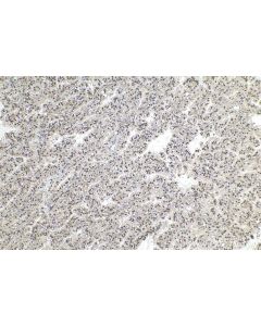 IHC easy ® UBE2I/UBC9 Ready-To-Use IHC Kit KHC0905 proteintech