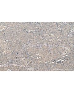 IHC easy ® TYMP Ready-To-Use IHC Kit KHC0926 proteintech
