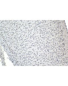 IHC easy ® FUS/TLS Ready-To-Use IHC Kit KHC0937 proteintech