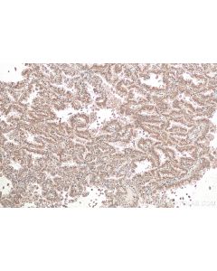 IHC easy ® UFM1 Ready-To-Use IHC Kit KHC0949 proteintech