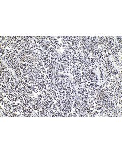 IHC easy ® USP11 Ready-To-Use IHC Kit KHC1026 proteintech