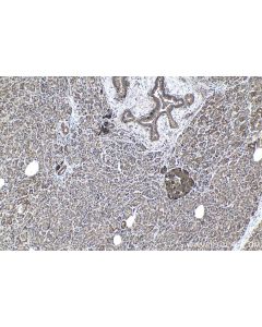 IHC easy ® UFD1 Ready-To-Use IHC Kit KHC1037 proteintech