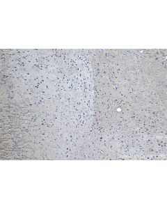 IHC easy ® CUL3 Ready-To-Use IHC Kit KHC1066 proteintech