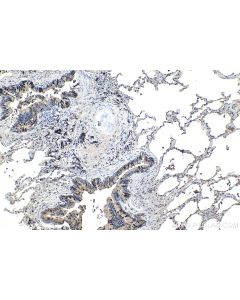 IHC easy ® Uteroglobin/SCGB1A1 Ready-To-Use IHC Kit KHC1091 proteintech