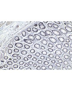 IHC easy ® DNAJC9 Ready-To-Use IHC Kit KHC1129 proteintech