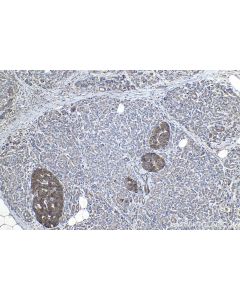 IHC easy ® GRN Ready-To-Use IHC Kit KHC1132 proteintech