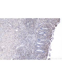 IHC easy ® UNC13D Ready-To-Use IHC Kit KHC1158 proteintech