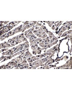 IHC easy ® UNG Ready-To-Use IHC Kit KHC1170 proteintech