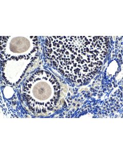 IHC easy ® XRCC4 Ready-To-Use IHC Kit KHC1184 proteintech