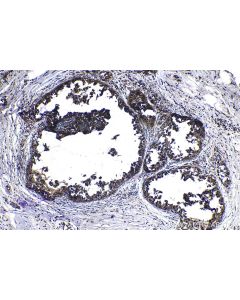 IHC easy ® PTGES3 Ready-To-Use IHC Kit KHC1186 proteintech