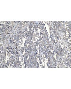 IHC easy ® UBTD1 Ready-To-Use IHC Kit KHC1189 proteintech