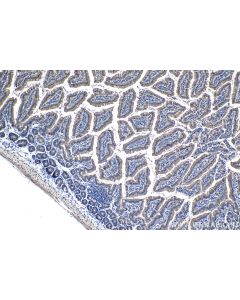 IHC easy ® UPP1 Ready-To-Use IHC Kit KHC1237 proteintech