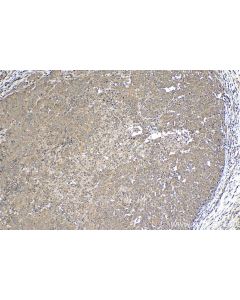 IHC easy ® MEI1 Ready-To-Use IHC Kit KHC1261 proteintech