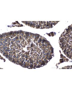 IHC easy ® WNK1 Ready-To-Use IHC Kit KHC1294 proteintech