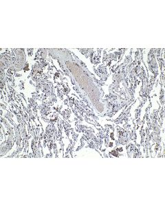 IHC easy ® VEGFC Ready-To-Use IHC Kit KHC1323 proteintech