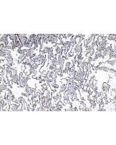 IHC easy ® CRLS1 Ready-To-Use IHC Kit KHC1360 proteintech