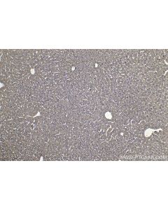 IHC easy ® UQCRB Ready-To-Use IHC Kit KHC1400 proteintech