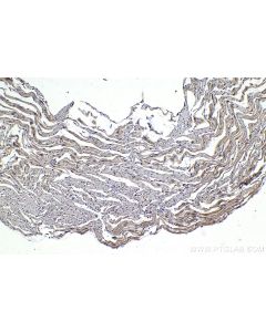 IHC easy ® BMAL1/ARNTL Ready-To-Use IHC Kit KHC1421 proteintech