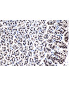 IHC easy ® ZBTB7B Ready-To-Use IHC Kit KHC1435 proteintech