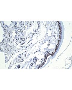 IHC easy ® CLOCK Ready-To-Use IHC Kit KHC1447 proteintech
