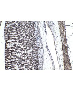 IHC easy ® PHF1 Ready-To-Use IHC Kit KHC1450 proteintech
