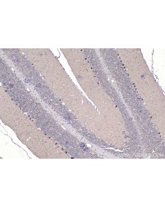 IHC easy ® ZIC3 Ready-To-Use IHC Kit KHC1467 proteintech