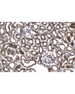 IHC easy ® ZMPSTE24 Ready-To-Use IHC Kit KHC1478 proteintech